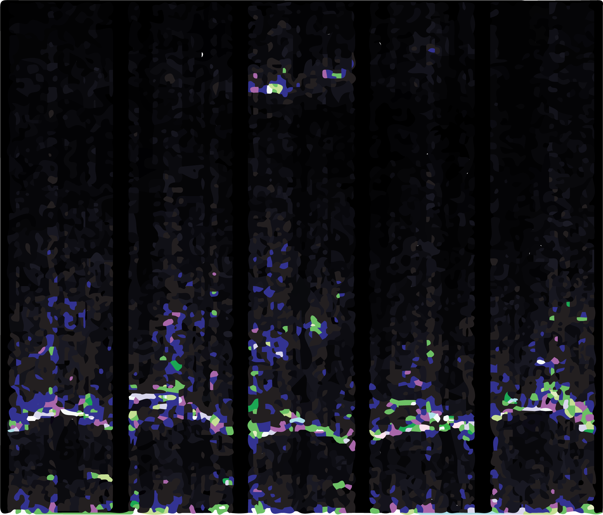 M-mode ultrasound image of tongue when saying 'Alpha'